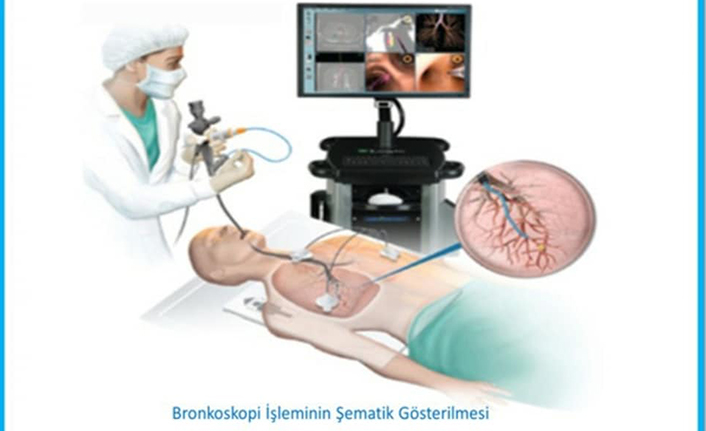 Devlet Hastanesi’ne Bronoskopi Cihazı