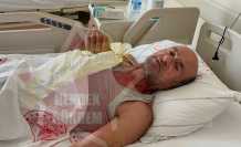 Hendek’te Ayı Saldırısı 1 Yaralı